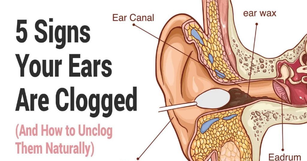 Signs Of Clogged Ears And How To Unclog Them Kaiser Magazine