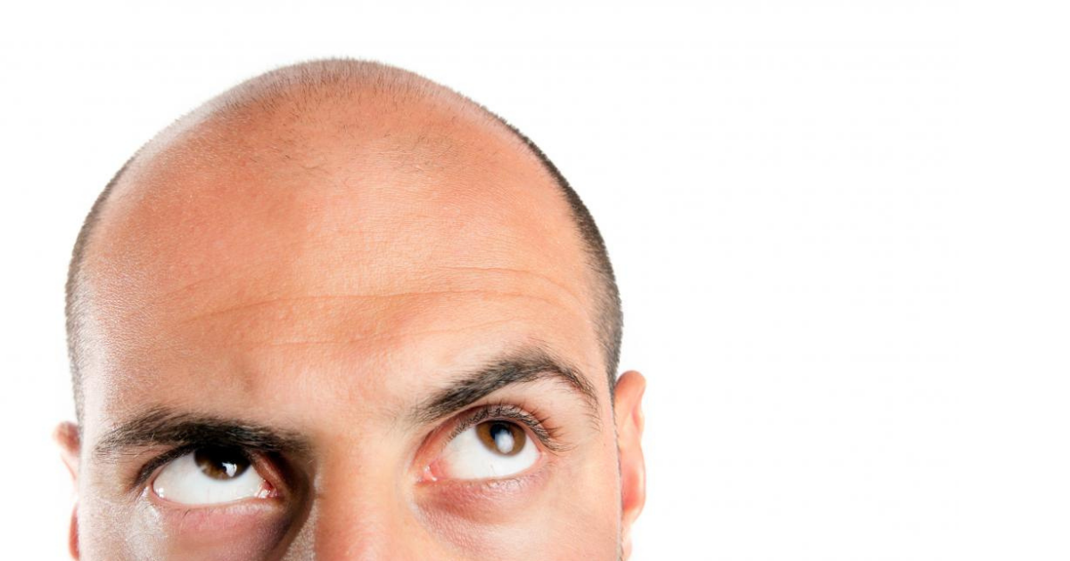 5 Worst Hairstyles For Balding Men